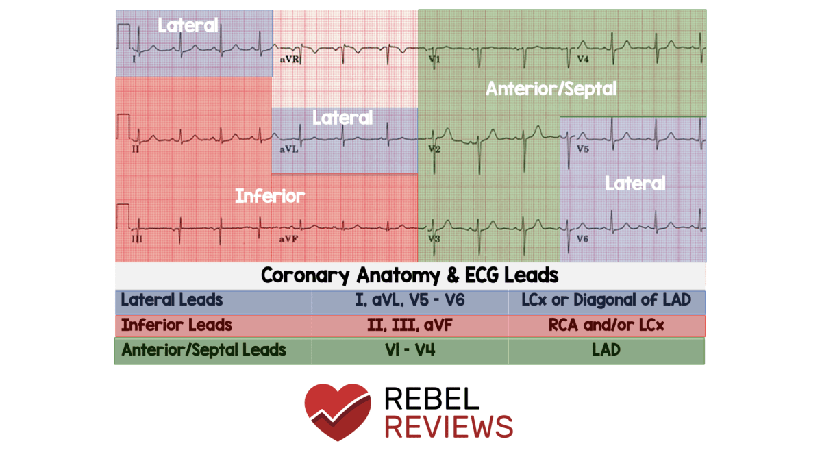 leads for ekg