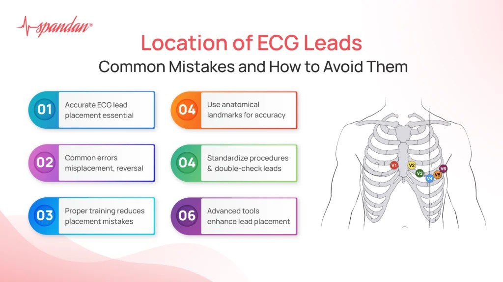 leads on ecg